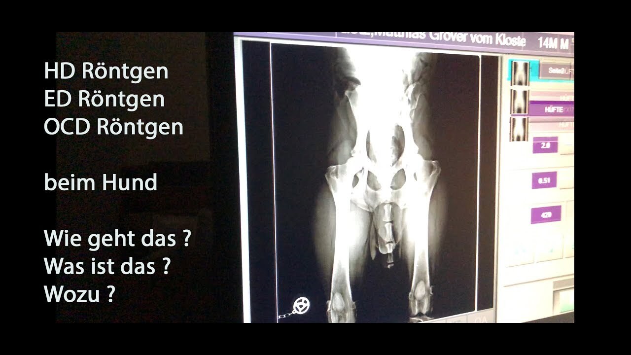 HD-, ED- und OCD-Röntgen