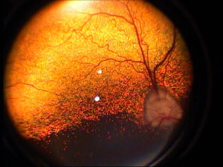 Indirekte Ophthalmoskopie beim Hund