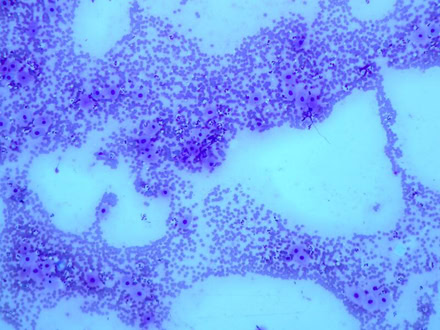 Scheidenabstrich zur Deckzeitpunktbestimmung bei der Hündin