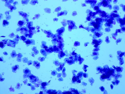 vagunalzytologie (scheidenabstrich)2 Vaginalzytologie zur Deckzeitpunktbestimmung bei der Hündin